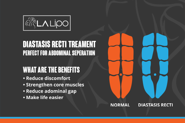 When Should You Consider Professional Help for Core Recovery South Ruislip