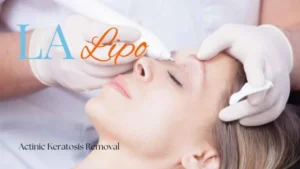 Woman receiving Actinic Keratosis Removal Treatment South Ruislip