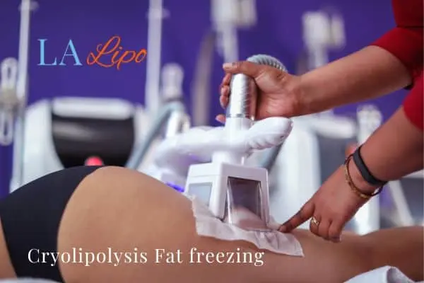 women getting fat freezing South Ruislip