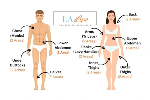 LA LIPO Cryolipolysis Areas South Ruislip