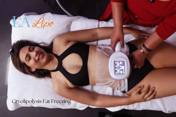 woman getting cryolipolysis South Ruislip