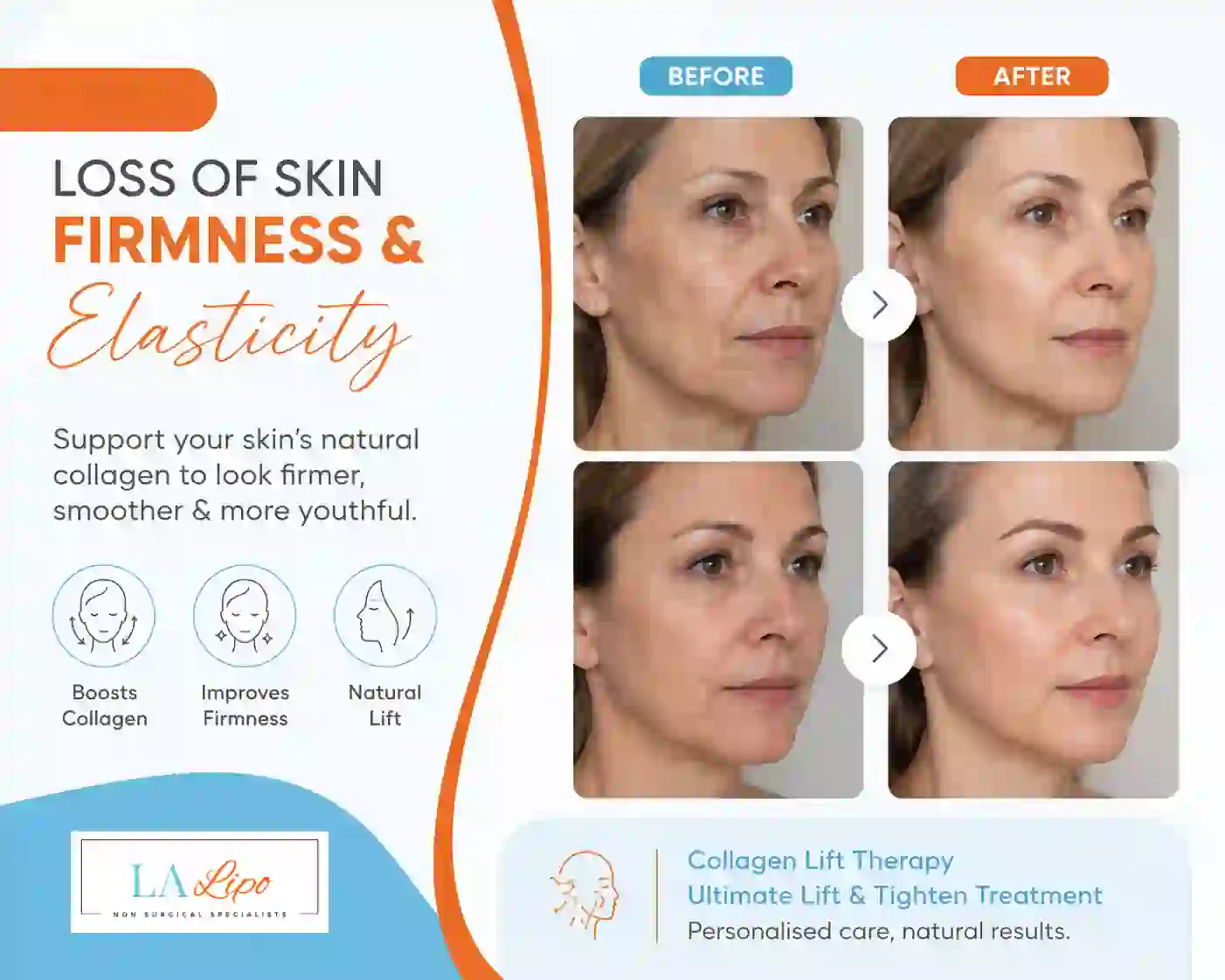 Sign #7: Loss of Skin Firmness and Elasticity South Ruislip
